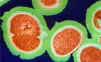 drug-resistant 'flesh-eating' MRSA bacteria hits MSM in san francisco and boston
